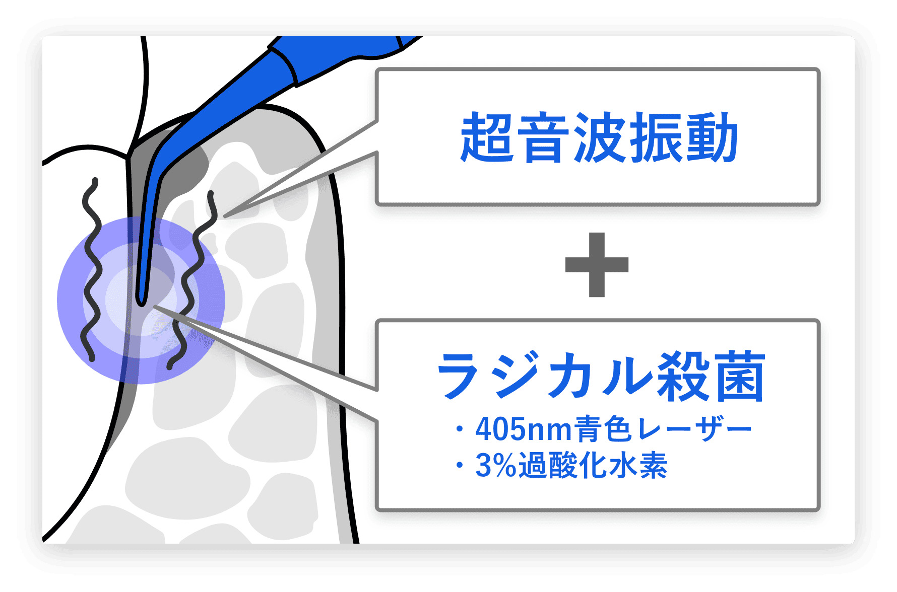 潜入:光感受性ジェルが細菌の要塞に浸透
