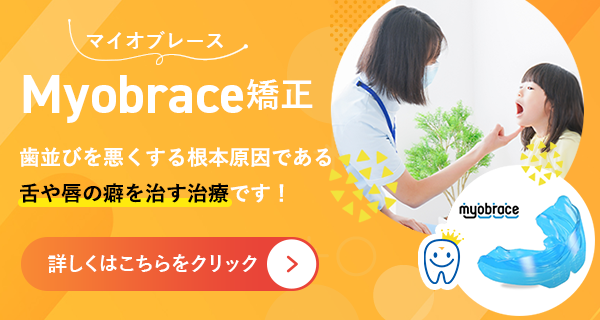 マイオブレースMyobrace矯正 歯並びを悪くする根本原因である舌や唇の癖を治す治療です!